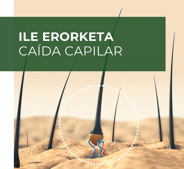 caida capilar