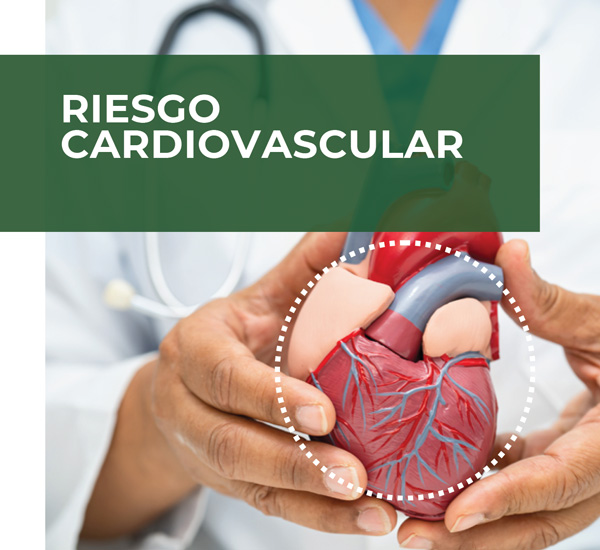 riesgo cardiovascular